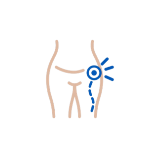 Hip pain and sciatica osteopathy treatment